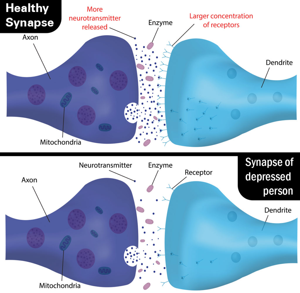 healthy synapse vs depressed synapse : Illustration